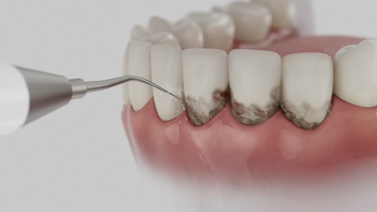 Reliable Dental contractor in St. Peter, WI by Dentist Open Now